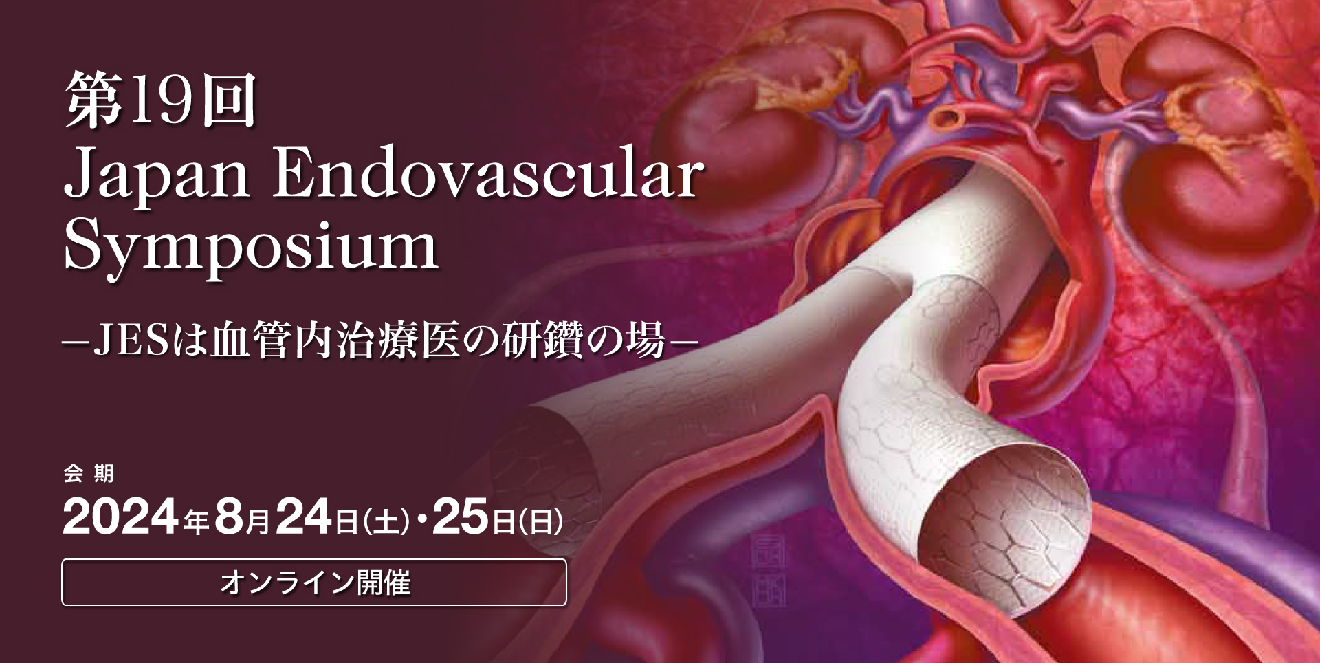 第19回 Japan Endovascular Symposium —JESは血管内治療医の研鑽の場—